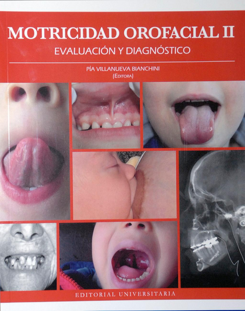 Motricidad Orofacial II Evaluacion y Diagnostico - Pia Villanueva Bianchini